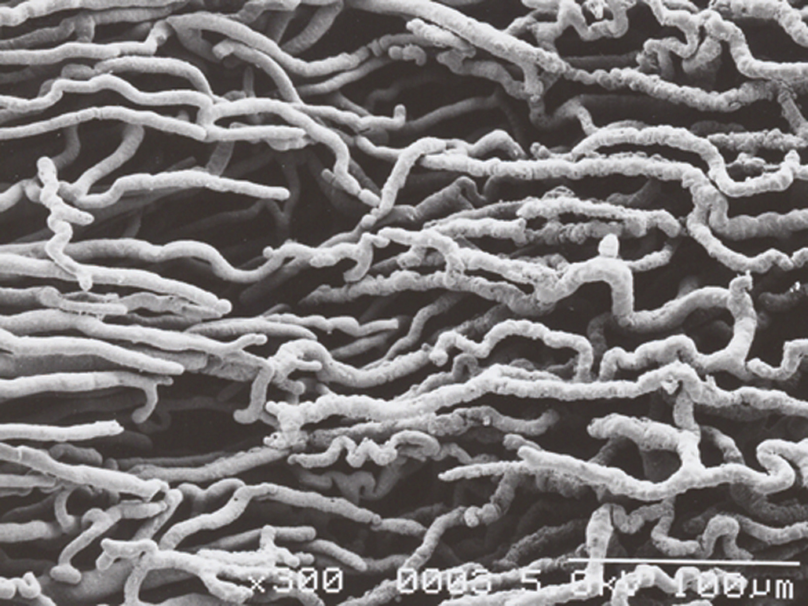 Replica des Cardiovaskular-Systems einer Ratte - Au-Sputter, 300x